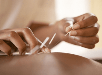 Acupuncture Can Help You Set Yourself Up for Success