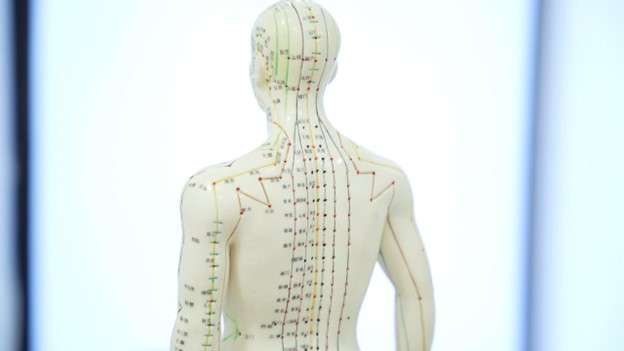 Acupuncture Can Help You Set Yourself Up for Success