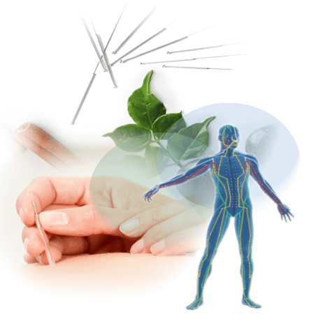 Acupuncture Can Help You Set Yourself Up for Success