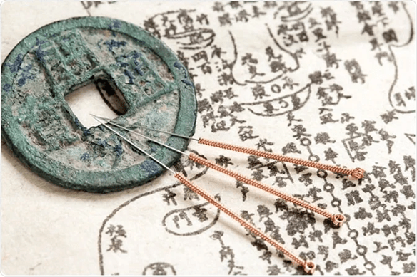 The Journey of Acupuncture
