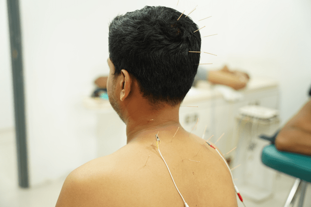 The Journey of Acupuncture