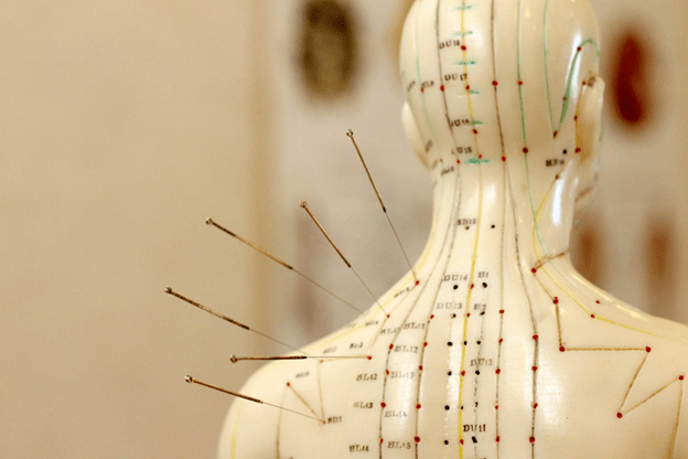 The Journey of Acupuncture