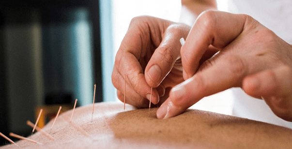 The Journey of Acupuncture