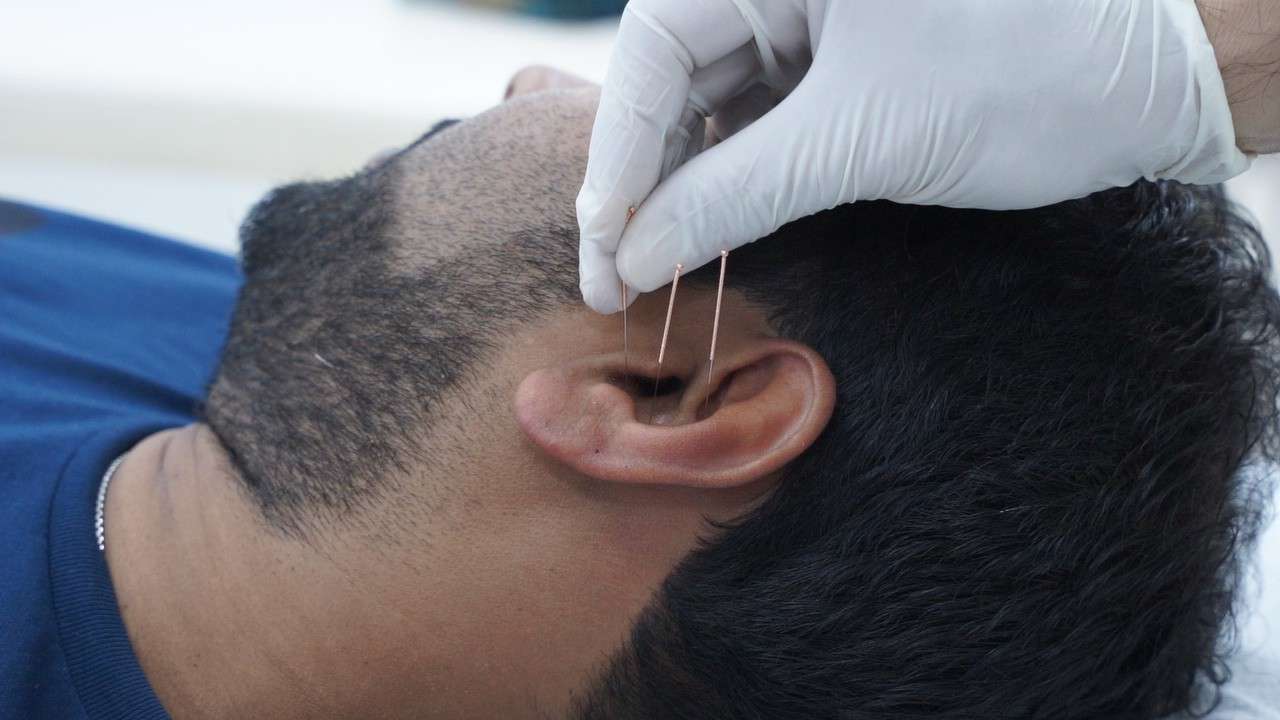 Acupuncture treatment for 27 Diseases | Ear Acupuncture