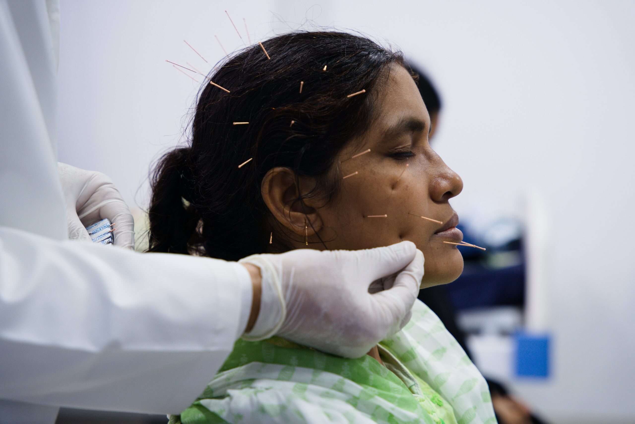 Acupuncture treatment for 27 Diseases | Face Acupuncture