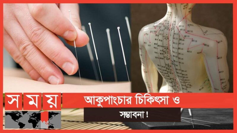 বদ্যি বাড়ি (Somoy TV) 'বন্ধ্যাত্বের ক্ষেত্রেও কার্যকর আকুপাংচার'