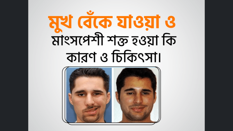 মুখ বেঁকে যাওয়া ও মাংসপেশী শক্ত হওয়া (Facial spasm) কারণ, লক্ষণ এবং আকুপাংচার চিকিৎসা