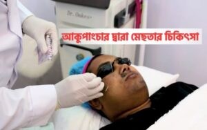 Melasma Treatment with Acupuncture