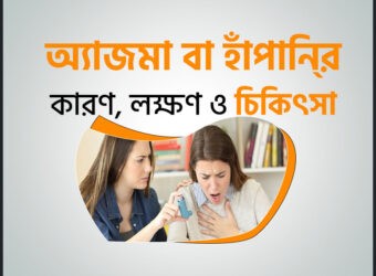 অ্যাজমা