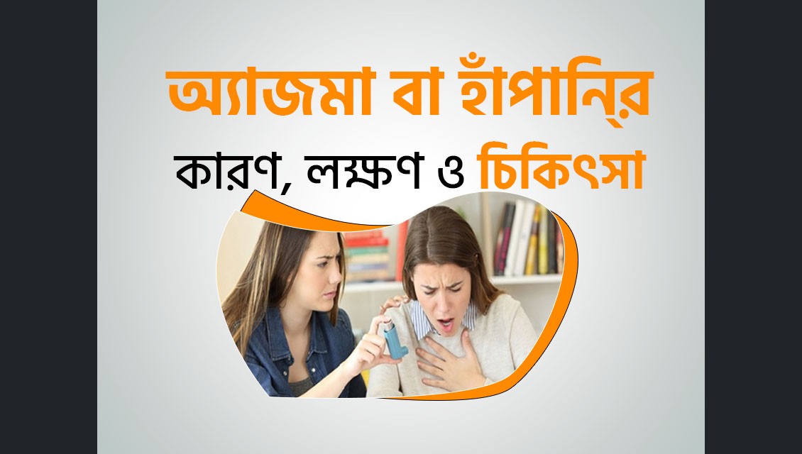 অ্যাজমা
