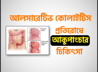 আলসারেটিভ কোলাইটিস কেন হয় ও মুক্তির উপায় | Ulcerative Colitis