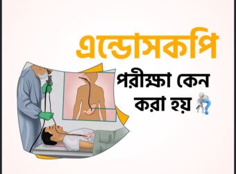 Endoscopy