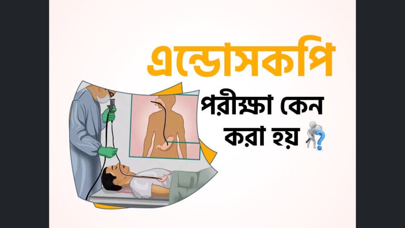 Endoscopy