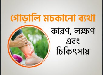 গোড়ালি মচকানো