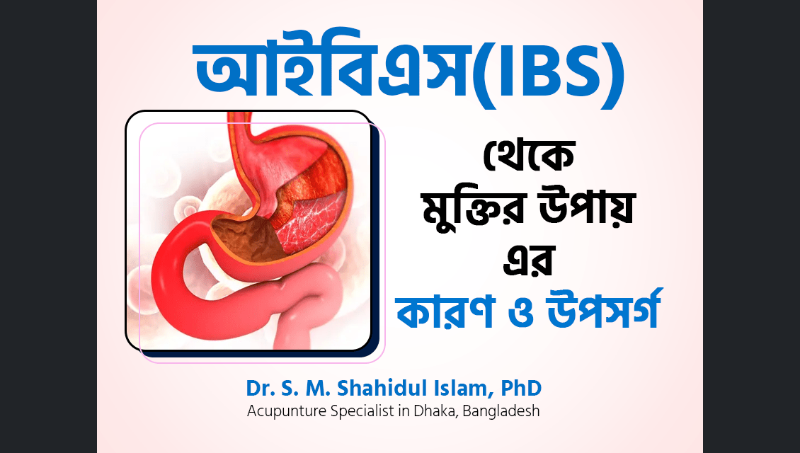 আইবিএস থেকে মুক্তির উপায়, আইবিএস রোগীর খাবার তালিক, আইবিএস এর আধুনিক চিকিৎসা, আইবিএস কি মানসিক রোগ, আইবিএস হলে কি কি সমস্যা হয়, আইবিএস কি ভালো হয়, আইবিএস এর ওষুধ, আইবিএস এর লক্ষণ ও প্রতিকার আইবিএস (IBS - Irritable Bowel Syndrome) কি? বলতে