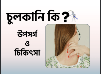 চুলকানি