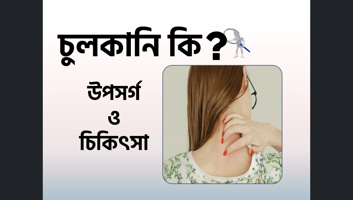 চুলকানি