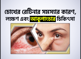 চোখের রেটিনায় সমস্যা