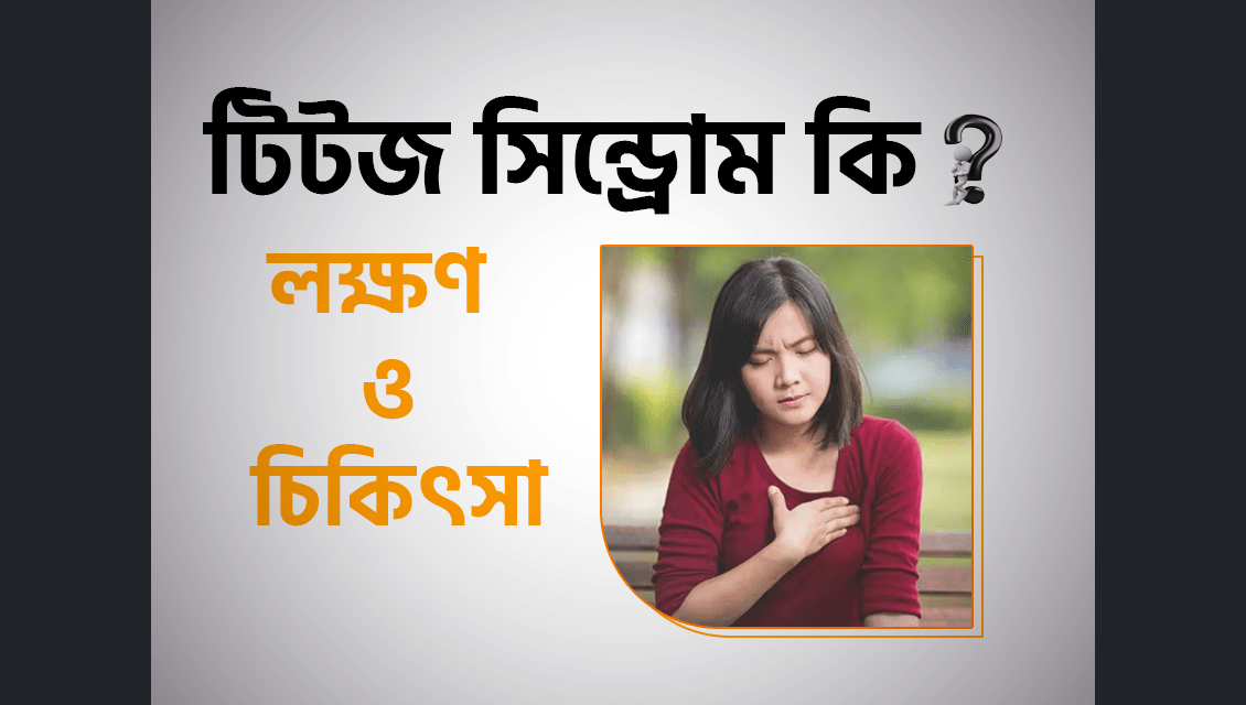 টিটজ সিন্ড্রোম