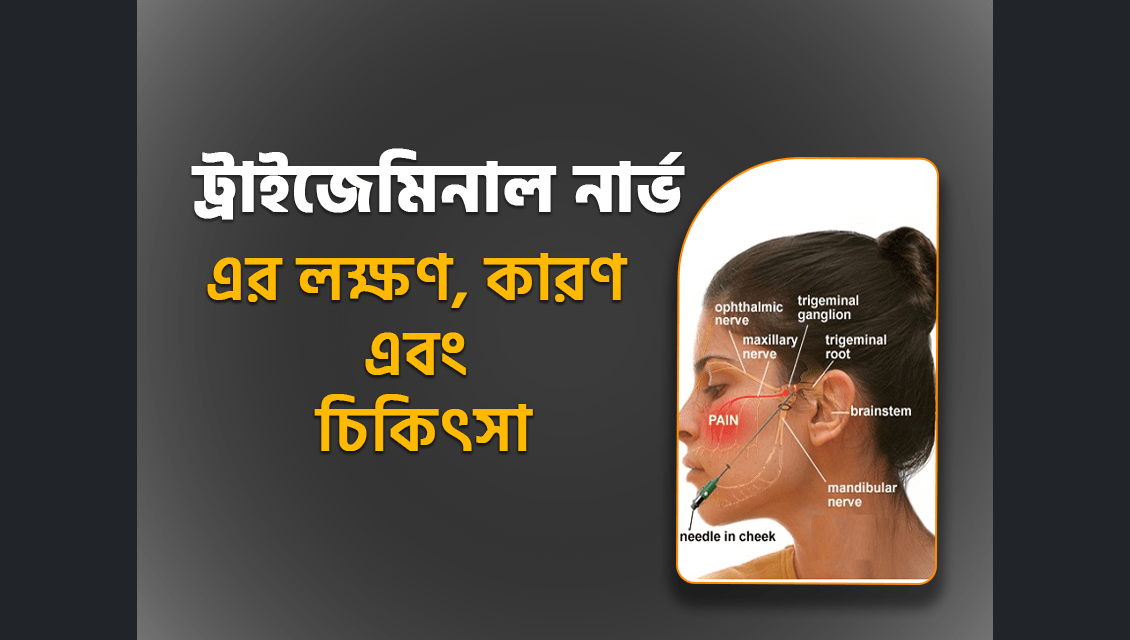 ট্রাইজেমিনাল নিউরালজিয়া রোগ কি? কারণ এবং চিকিৎসা