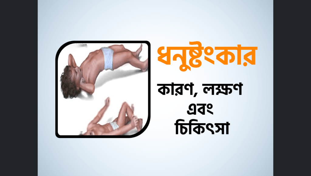 ধনুষ্টংকার (Tetanus) কারণ, লক্ষণ এবং চিকিৎসা