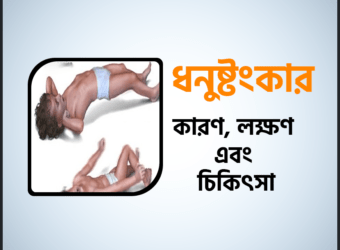 ধনুষ্টংকার (Tetanus) কারণ, লক্ষণ এবং চিকিৎসা