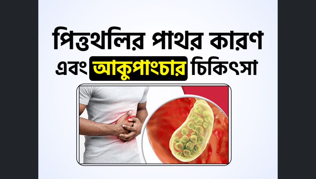 পিত্তথলির পাথর (Cholelithiasis) কারণ এবং আকুপাংচার চিকিৎসা