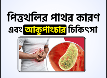 পিত্তথলির পাথর (Cholelithiasis) কারণ এবং আকুপাংচার চিকিৎসা