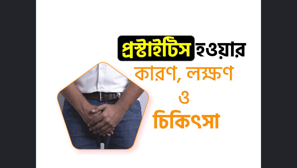 প্রস্টাইটিস