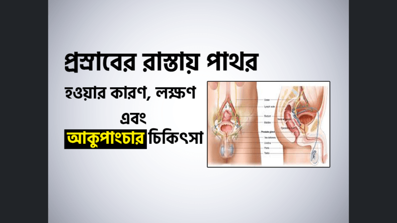মূত্র পাথরি (Urinary Stones) হওয়ার কারণ, লক্ষণ এবং চিকিৎসা