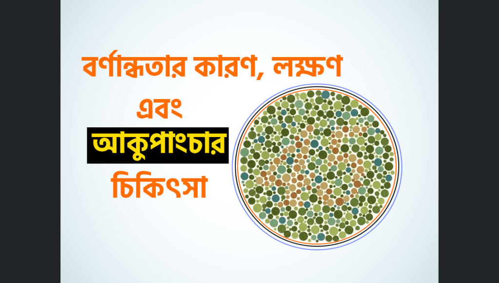 বর্ণান্ধতা (Color Blindness) কারণ, লক্ষণ এবং আকুপাংচার চিকিৎসা