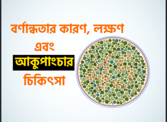 বর্ণান্ধতা (Color Blindness) কারণ, লক্ষণ এবং আকুপাংচার চিকিৎসা