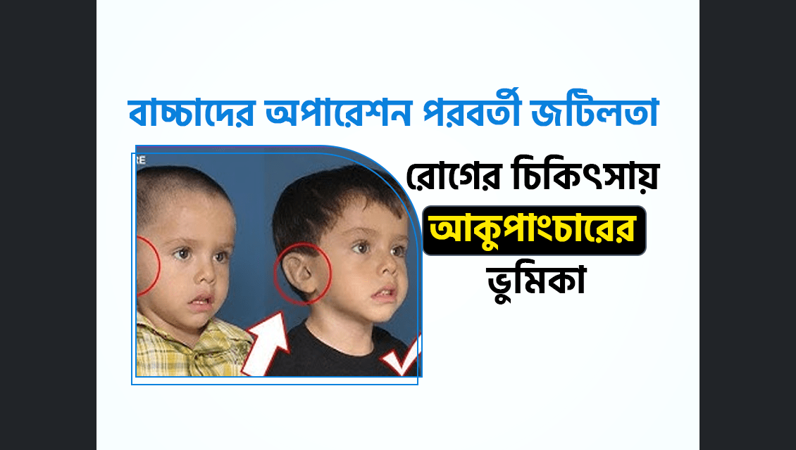 বাচ্চাদের অপারেশন পরবর্তী জটিলতা সিজার পরবর্তী জটিলতা