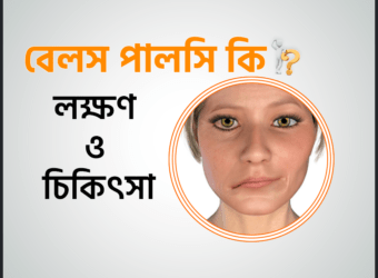 বেলস পালসি