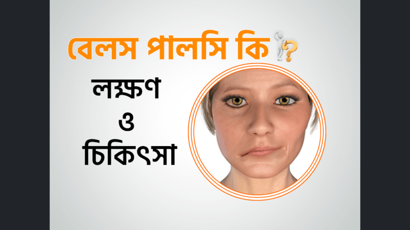বেলস পালসি