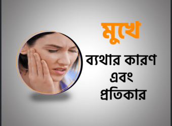 মুখে ব্যথার (Facial Pain) কারণ এবং প্রতিকার