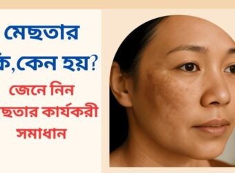জেনে নিন মেছতার কার্যকরী সমাধান!