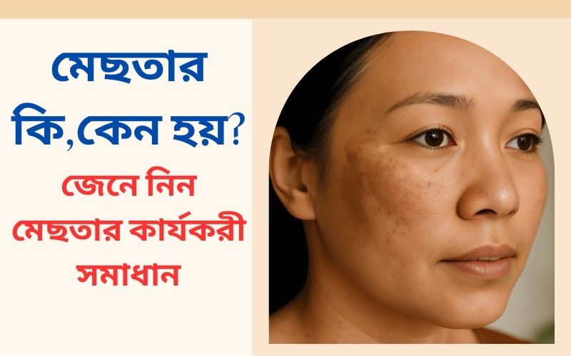 জেনে নিন মেছতার কার্যকরী সমাধান!