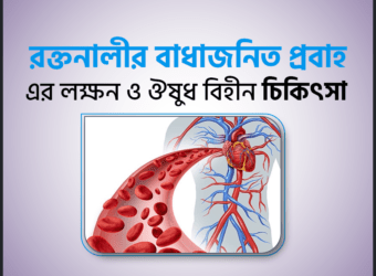 রক্তনালীর বাধাজনিত প্রবাহ এর লক্ষন ও ঔষুধ বিহীন চিকিৎসা