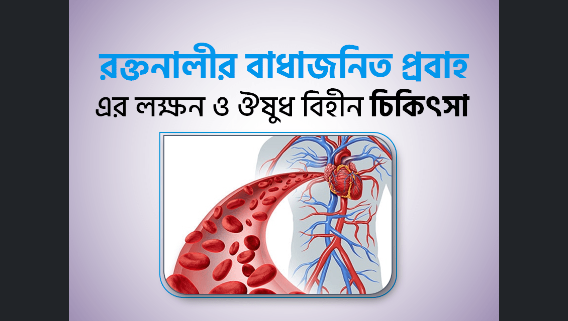 রক্তনালীর বাধাজনিত প্রবাহ এর লক্ষন ও ঔষুধ বিহীন চিকিৎসা