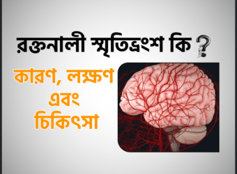 ভাস্কুলার ডিমেনশিয়া বা রক্তনালী স্মৃতিভ্রংশ এর চিকিৎসা, কারণ ও লক্ষণ