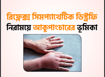 রিফ্লেক্স সিমপ্যাথেটিক ডিস্ট্রফি