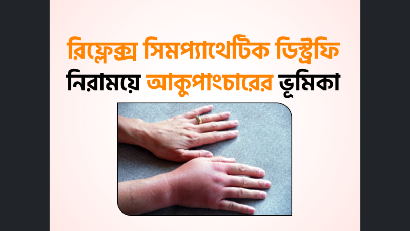 রিফ্লেক্স সিমপ্যাথেটিক ডিস্ট্রফি