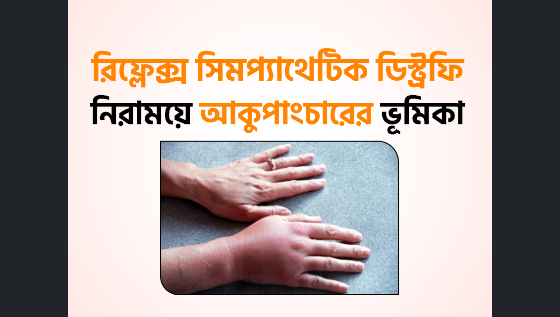 রিফ্লেক্স সিমপ্যাথেটিক ডিস্ট্রফি