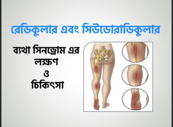 রেডিকুলার এবং সিউডোরাডিকুলার