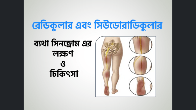 রেডিকুলার এবং সিউডোরাডিকুলার