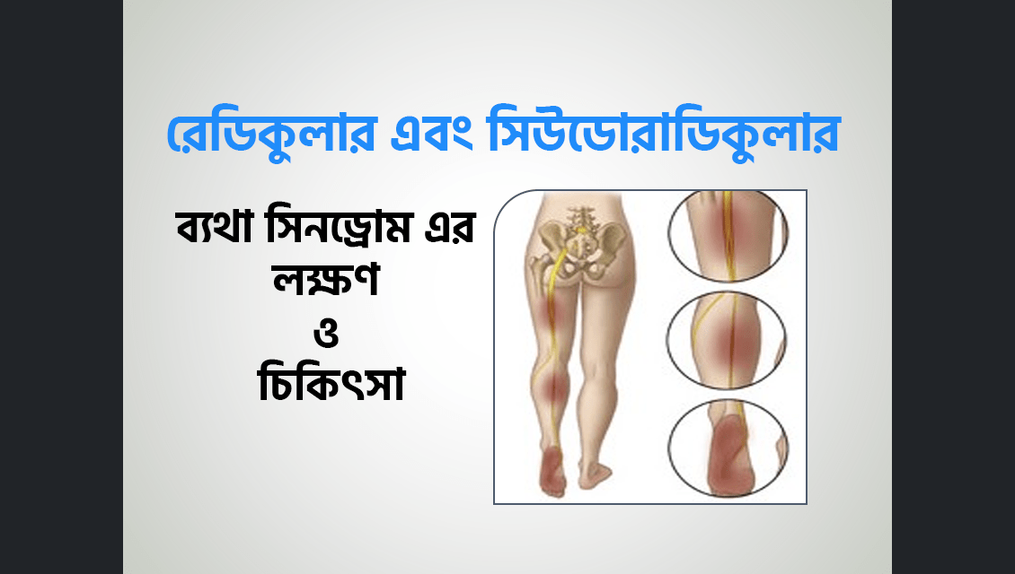 রেডিকুলার এবং সিউডোরাডিকুলার
