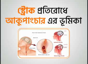 স্ট্রোক