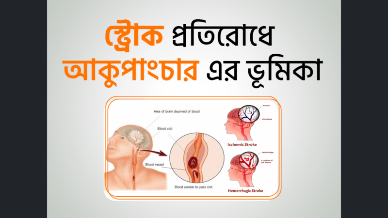 স্ট্রোক