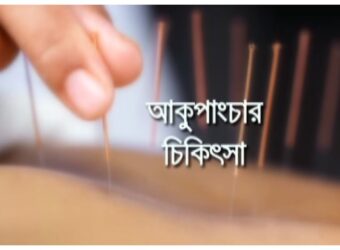 স্বাস্থ্য বিষয়ক অনুষ্ঠান ‍‍আকুপাংচার চিকিৎসা
